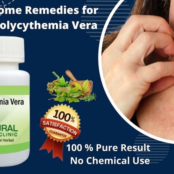 Best Home Remedies for Polycythemia Vera: Discover the Power of Nature is being swapped online for free