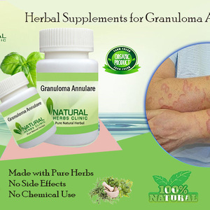 Say Goodbye to Granuloma Annulare with These Proven Remedies! is being swapped online for free