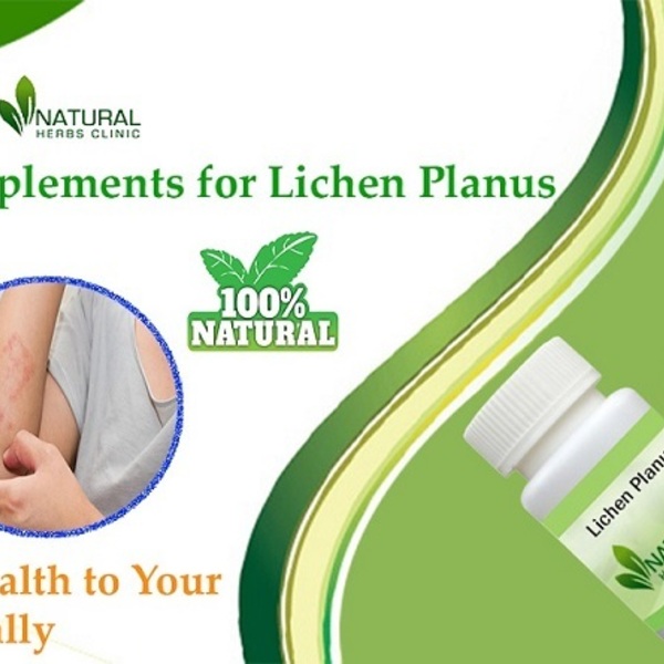 Lichen Planus Natural Alternative Treatment With Herbal Remedies is being swapped online for free