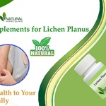 Lichen Planus Natural Alternative Treatment With Herbal Remedies is being swapped online for free