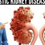 Top 5 Medications for Polycystic Kidney Disease: Expert Recommendations is being swapped online for free