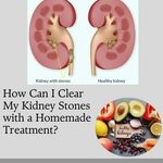 How Can I Clear My Kidney Stones with a Homemade Treatment? is being swapped online for free